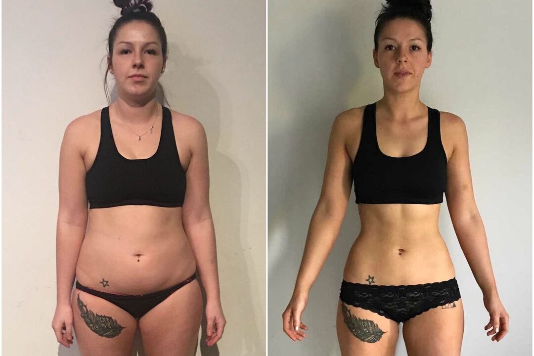 antes e depois da perda de peso
